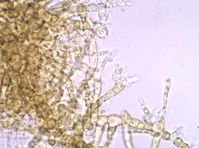 [alaesc6]: Male filamentous gametophyte.