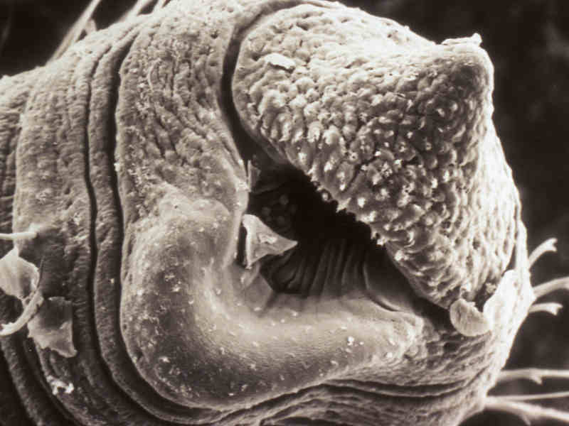 Electron micrograph of the head of Tubifex tubifex.